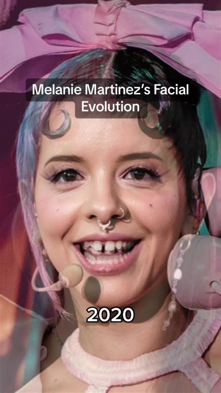 Unveiling Melanie Martinez's Surgical Transformations: Truth Or Speculation?